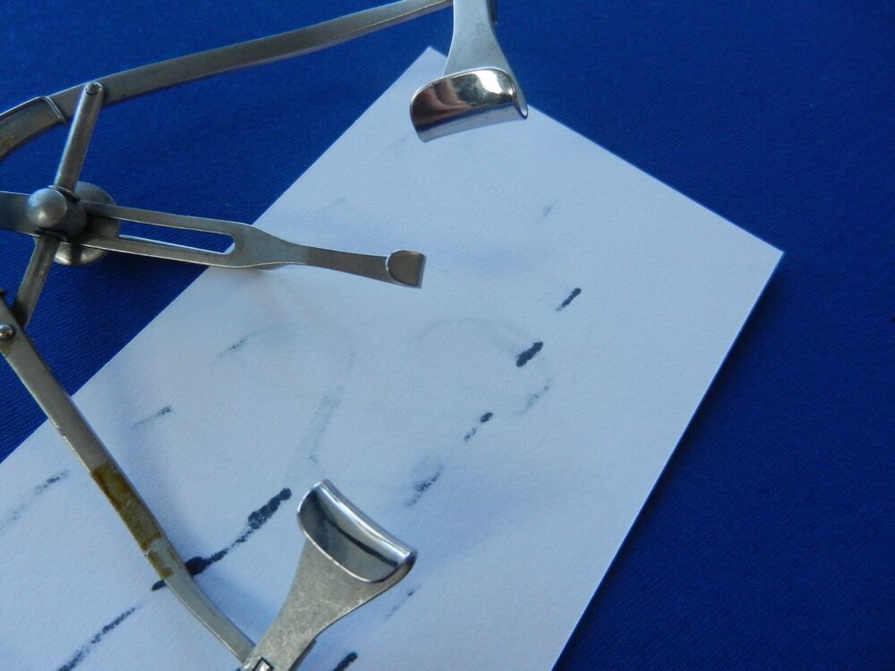 E4896 Storz E4007 Maumenee Park Speculum with Canthus Bar 80mm Overall Length - Image 4