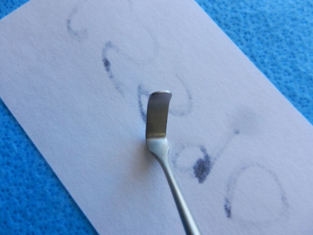Aesculap Surgical Meyerding Thumb Retractor BT193R - Image 4